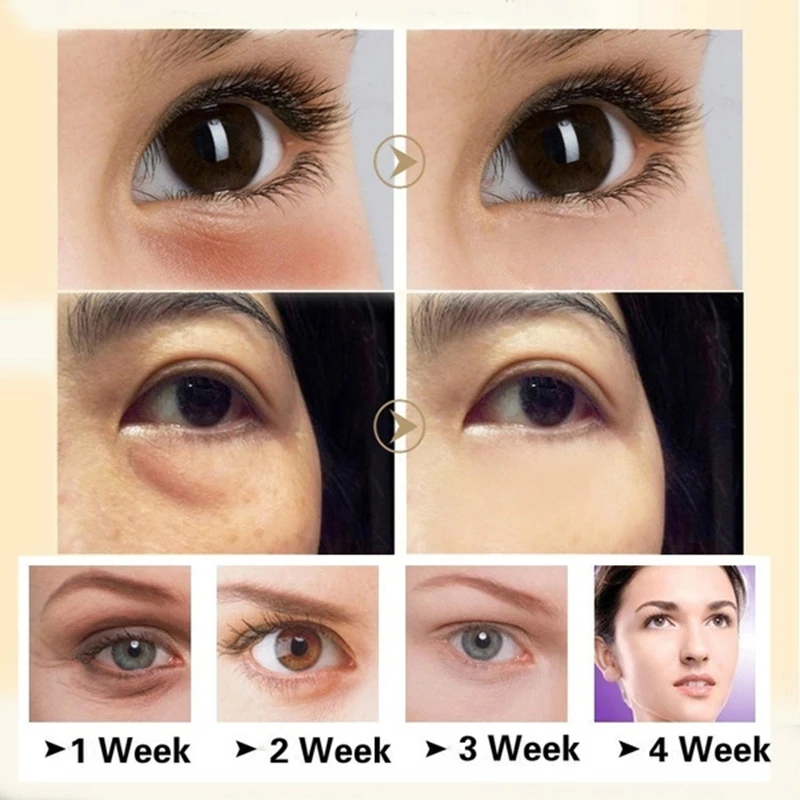 Effective Anti-Wrinkle Whitening Skin Care Horse Oil Cream Anti-aging Face Cream Eye Serum Remove Fat Granule Dark Circles 40g
Effective Anti-Wrinkle Whitening Skin Care Horse Oil Cream Anti-aging Face Cream Eye Serum Remove Fat Granule Dark Circles 40g