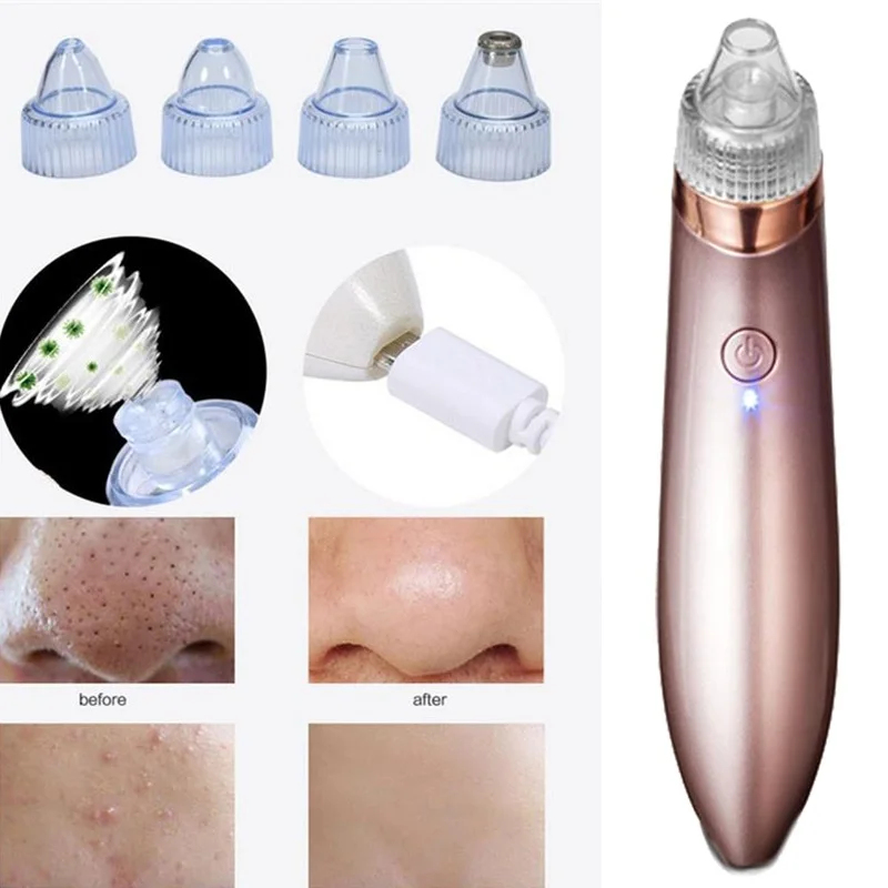 Pore Cleaner USB Electric & Battery Blackhead Black Dot Remover Face Pore Acne Pore Cleaner Pimple Removal Vacuum Suction Tools
Pore Cleaner USB Electric & Battery Blackhead Black Dot Remover Face Pore Acne Pore Cleaner Pimple Removal Vacuum Suction Tools