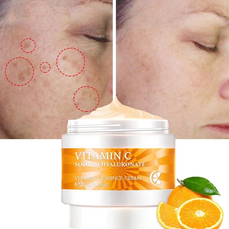 Vitamin C Whitening Face Cream VC Essence Day Cream Dark Spot Remover Brighten Faded Freckle Antioxidant Anti Aging Skin Care
Vitamin C Whitening Face Cream VC Essence Day Cream Dark Spot Remover Brighten Faded Freckle Antioxidant Anti Aging Skin Care