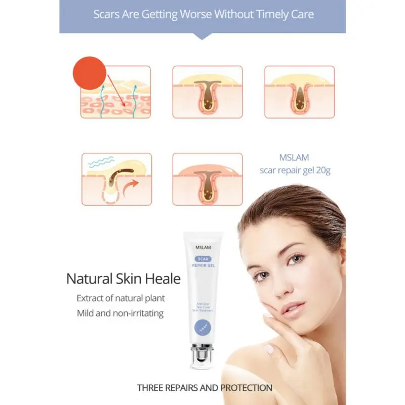 Nourish Skin Scar Repair Gel Removal Scar Acne Cream Repair Scar Acne Repair Essence Gel Face And Body Skin Care Products
Nourish Skin Scar Repair Gel Removal Scar Acne Cream Repair Scar Acne Repair Essence Gel Face And Body Skin Care Products