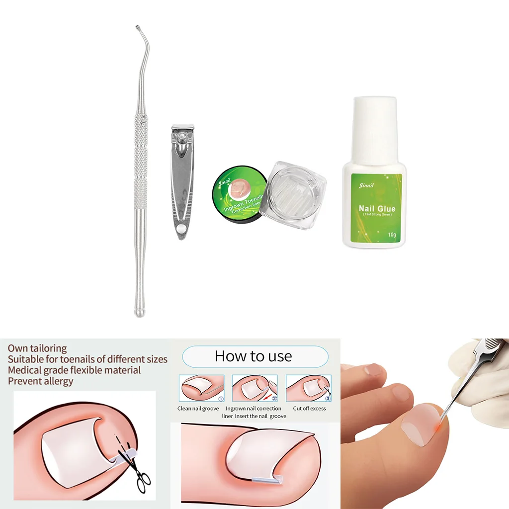 Professional Ingrown Toenail Correction Pad C-shaped Ingrown Tools Clippers Nail Cleaners Podiatry Silicone Straightening Clip
Professional Ingrown Toenail Correction Pad C-shaped Ingrown Tools Clippers Nail Cleaners Podiatry Silicone Straightening Clip