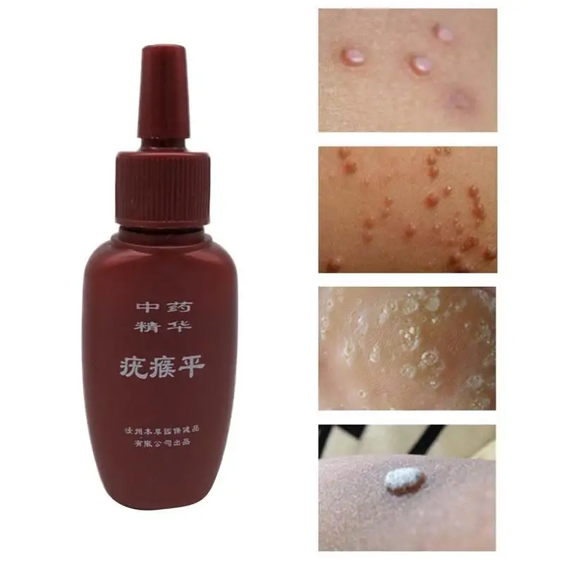 Effective Skin Tag Remover Gel Removal Mole & Papillomas Corn 
Effective Skin Tag Remover Gel Removal Mole & Papillomas Corn