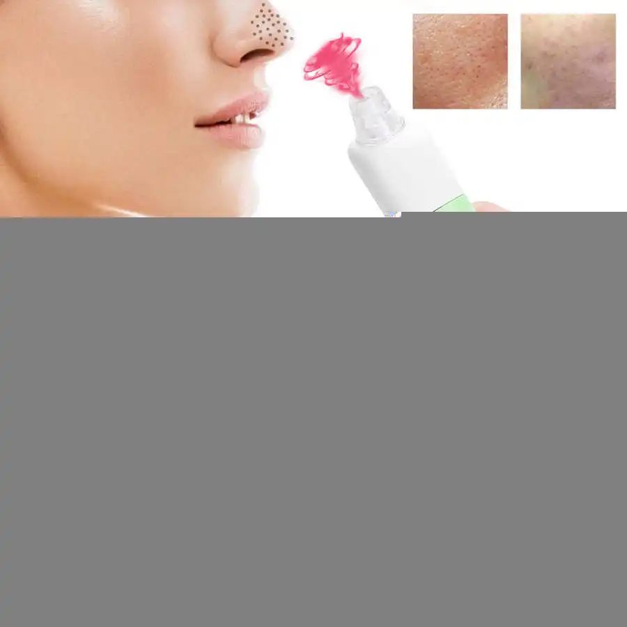 Acne Electric Blackhead Acne Removal Suction Instrument Household Adjustable Face Pore Cleaner Skin Tag Removal
Acne Electric Blackhead Acne Removal Suction Instrument Household Adjustable Face Pore Cleaner Skin Tag Removal