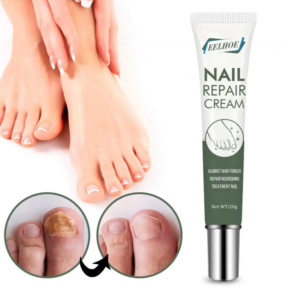 Minimalistic 20g/Bottle Useful Nail Fungus Repair Treatment Gel Healthy Nail Treatment Cream Painless for Feet
Minimalistic 20g/Bottle Useful Nail Fungus Repair Treatment Gel Healthy Nail Treatment Cream Painless for Feet