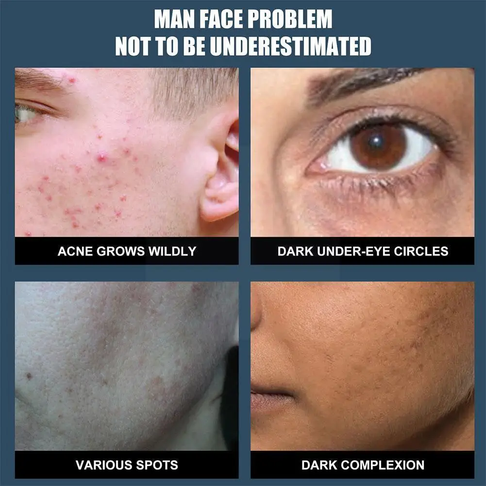 Whitening Cream For Men Skin Whitening Concealer Cream Moisturizing Non-greasy Face Makeup Nutrient A9X1
Whitening Cream For Men Skin Whitening Concealer Cream Moisturizing Non-greasy Face Makeup Nutrient A9X1