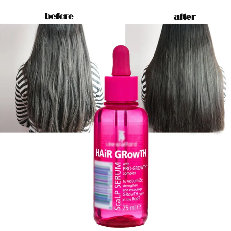 Britain Anti alopecia solid hair essential oil 75ml to accelerate hair growth,Nourish hair roots
Britain Anti alopecia solid hair essential oil 75ml to accelerate hair growth,Nourish hair roots