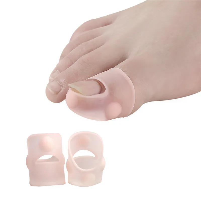 1Pair Ingrown Armor Elastic Patch Straightening Clip Brace Toenail Correction Tool Toe Nail Treatment Pedicure | Красота и здоровье