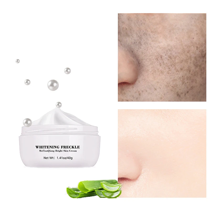 Powerful Whitening Freckle Cream Remove Melasma Acne Spots Pigment Melanin Dark Spots Face Lift Firming Face Care Cream 40g
Powerful Whitening Freckle Cream Remove Melasma Acne Spots Pigment Melanin Dark Spots Face Lift Firming Face Care Cream 40g