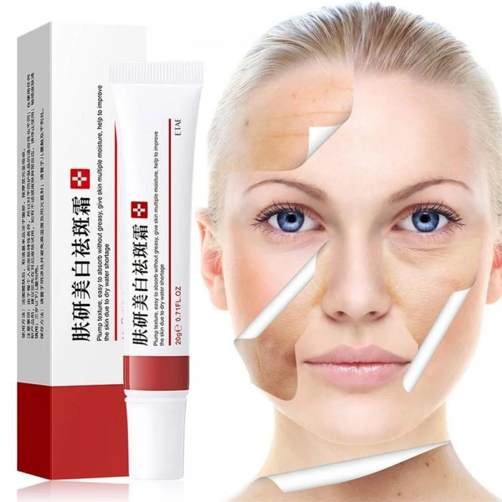 Effective Whitening Freckle Cream Remove Melasma Acne Spot Pigment Melanin Dark Spots Pigmentation Moisturizing Gel Skin Care
Effective Whitening Freckle Cream Remove Melasma Acne Spot Pigment Melanin Dark Spots Pigmentation Moisturizing Gel Skin Care