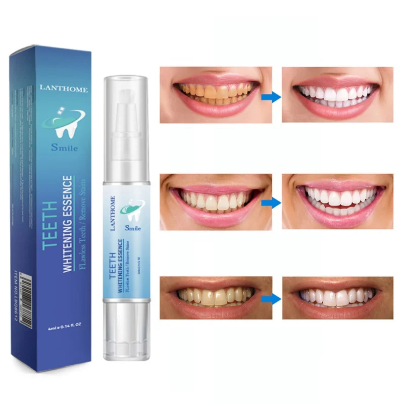 Tooth cigarette stain remover Teeth Cleaning Pen Quickly Remove Yellow Teeth Plaque Tooth Stains Oral Care Products
Tooth cigarette stain remover Teeth Cleaning Pen Quickly Remove Yellow Teeth Plaque Tooth Stains Oral Care Products