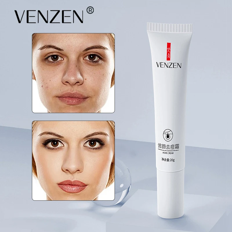 VENZEN Niacinamide Acne Remover Cream Acne Treatment Fade Acne Spots Oil Control Shrink Pores Moisturizing Repairing Skin Care
VENZEN Niacinamide Acne Remover Cream Acne Treatment Fade Acne Spots Oil Control Shrink Pores Moisturizing Repairing Skin Care