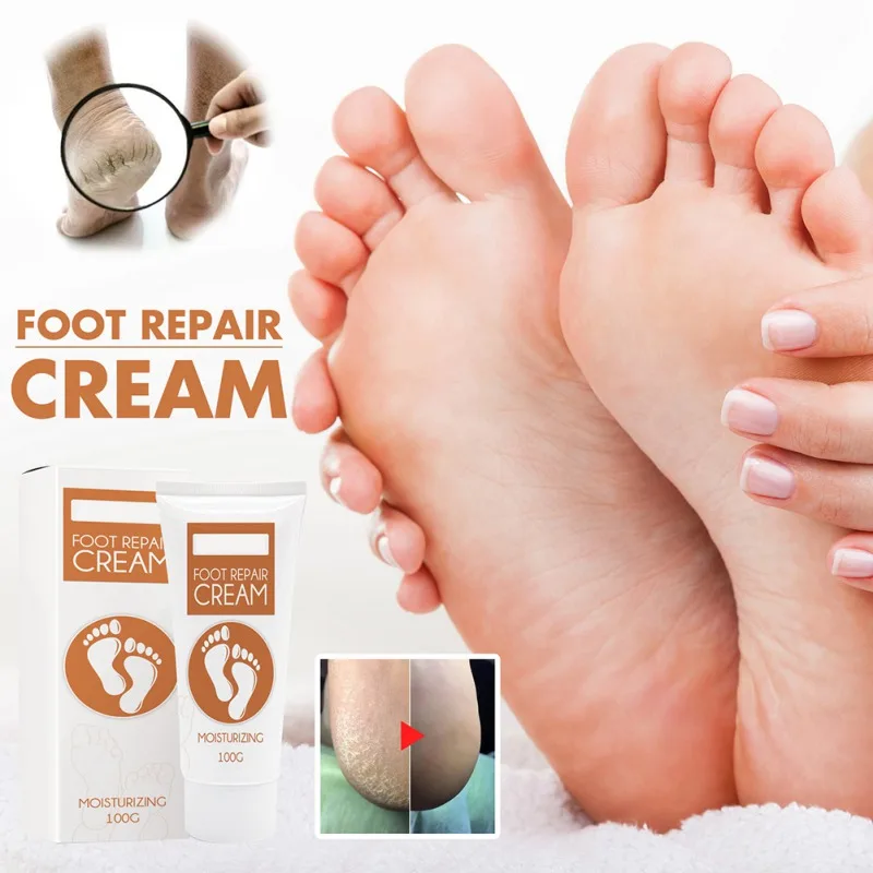 Противогрибковая инфекция, онихомикоз, грибок, восстановление сухой трещины, крем для ухода за ногами, эффективный уход за ногами, фототера...
Противогрибковая инфекция, онихомикоз, грибок, восстановление сухой трещины, крем для ухода за ногами, эффективный уход за ногами, фототера...