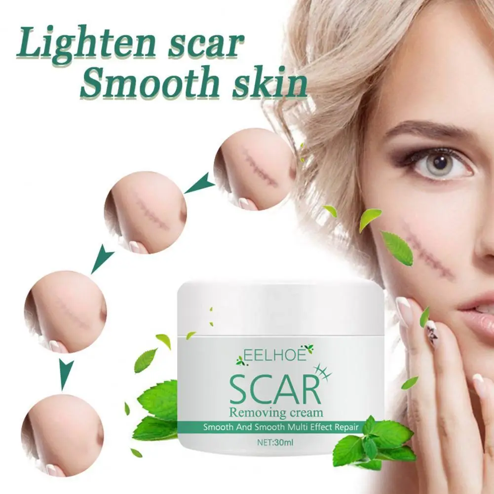 10ml/20ml/30ml/50ml Scar Cream Quick Absorption Penetrate Natural Extract Plant Acne Stretch Mark Remover Burn Cream for Female
10ml/20ml/30ml/50ml Scar Cream Quick Absorption Penetrate Natural Extract Plant Acne Stretch Mark Remover Burn Cream for Female