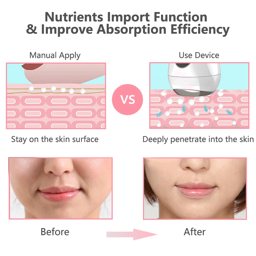 Mini Microcurrent Face Lift Devices Skin Tightening Vibration Massager Lontophoresis Essence Skin Rejuvenation Wrinkle Removal
Mini Microcurrent Face Lift Devices Skin Tightening Vibration Massager Lontophoresis Essence Skin Rejuvenation Wrinkle Removal