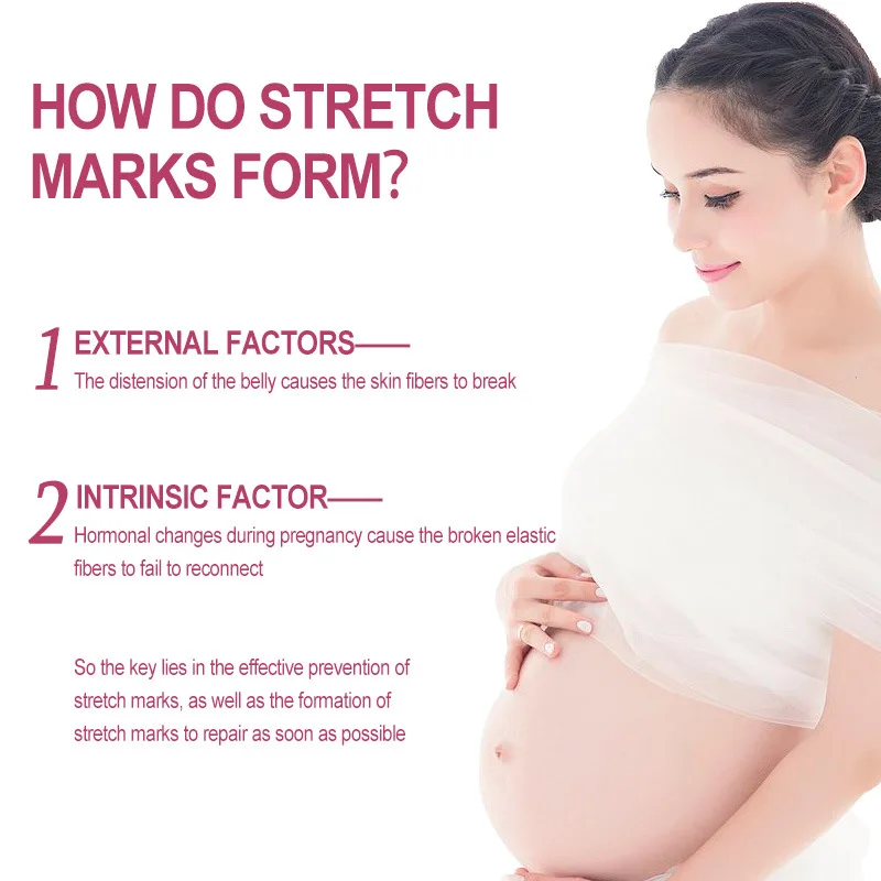 Removes Stretch Mark Cream To Remove Postpartum Obesity Pregnant Women Repair Anti-Aging Anti-Winkles Firming Body Cream
Removes Stretch Mark Cream To Remove Postpartum Obesity Pregnant Women Repair Anti-Aging Anti-Winkles Firming Body Cream