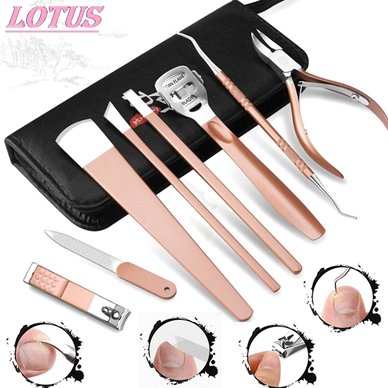 HOT Pedicure Foot Care Ingrown Removal Correction Clippers Toe Nail FileTools Foot Care Tool 7/8PCS 
HOT Pedicure Foot Care Ingrown Removal Correction Clippers Toe Nail FileTools Foot Care Tool 7/8PCS