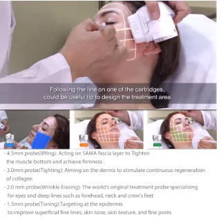 2021 NEW 7D Anti-aging Machine Antiwrinkle Beauty Equipment Face And Body Treatment Skin Tighten Machine
2021 NEW 7D Anti-aging Machine Antiwrinkle Beauty Equipment Face And Body Treatment Skin Tighten Machine