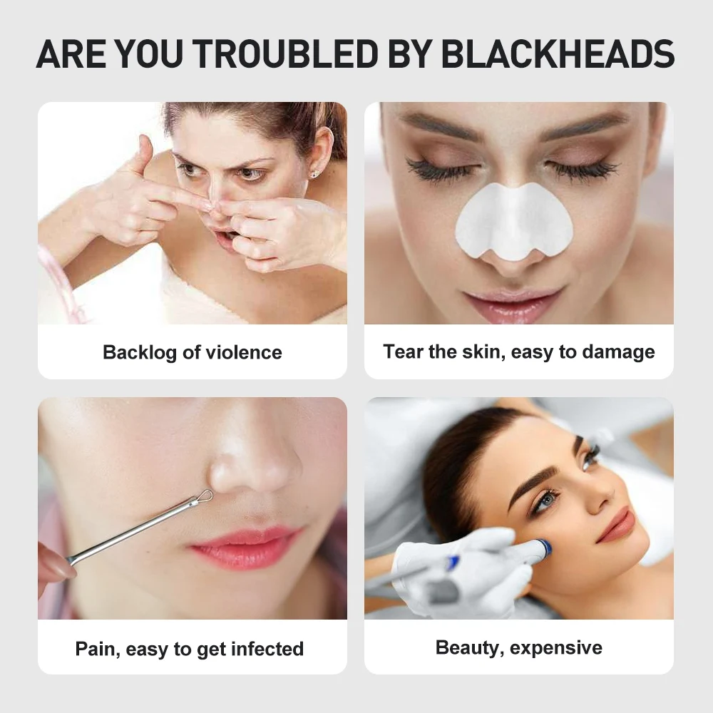 Black Point Vacuum Cleaner Black Dot Blackhead Remover Black Head Remover Vacuum Cleaner Black Dot Acne Pore Cleaner Skin Care
Black Point Vacuum Cleaner Black Dot Blackhead Remover Black Head Remover Vacuum Cleaner Black Dot Acne Pore Cleaner Skin Care