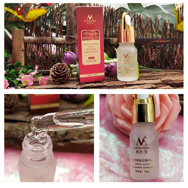 Acne Treatment Anti Acne Face Serum Cream Centella Asiatica Oil Control Shrink Pores Scar Remove Essence Whitening Skin Care 10g 
Acne Treatment Anti Acne Face Serum Cream Centella Asiatica Oil Control Shrink Pores Scar Remove Essence Whitening Skin Care 10g