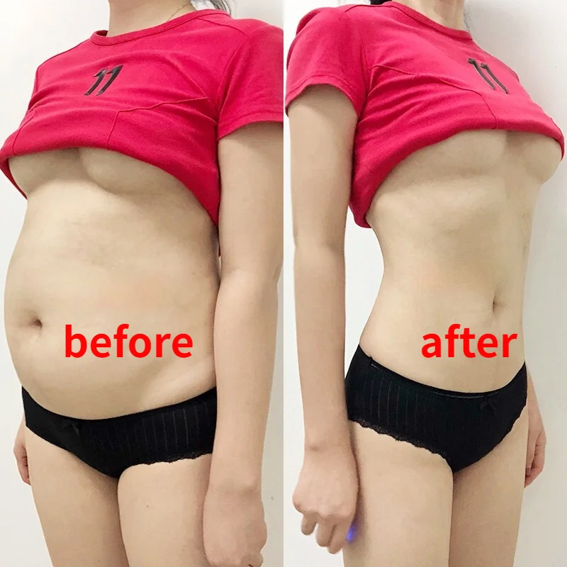таблетки для похуден 30Pcs Wonder Patch Quick Slimming Patch Belly Slim Patch Abdomen Fat burning Navel Stick Slimer Tool
таблетки для похуден 30Pcs Wonder Patch Quick Slimming Patch Belly Slim Patch Abdomen Fat burning Navel Stick Slimer Tool
