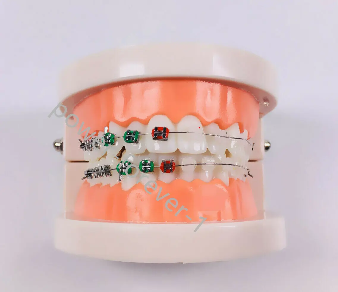1 Piece Dental Othodontic Ceramic Metal Brackets Brace Contast Typodont Elastics
1 Piece Dental Othodontic Ceramic Metal Brackets Brace Contast Typodont Elastics