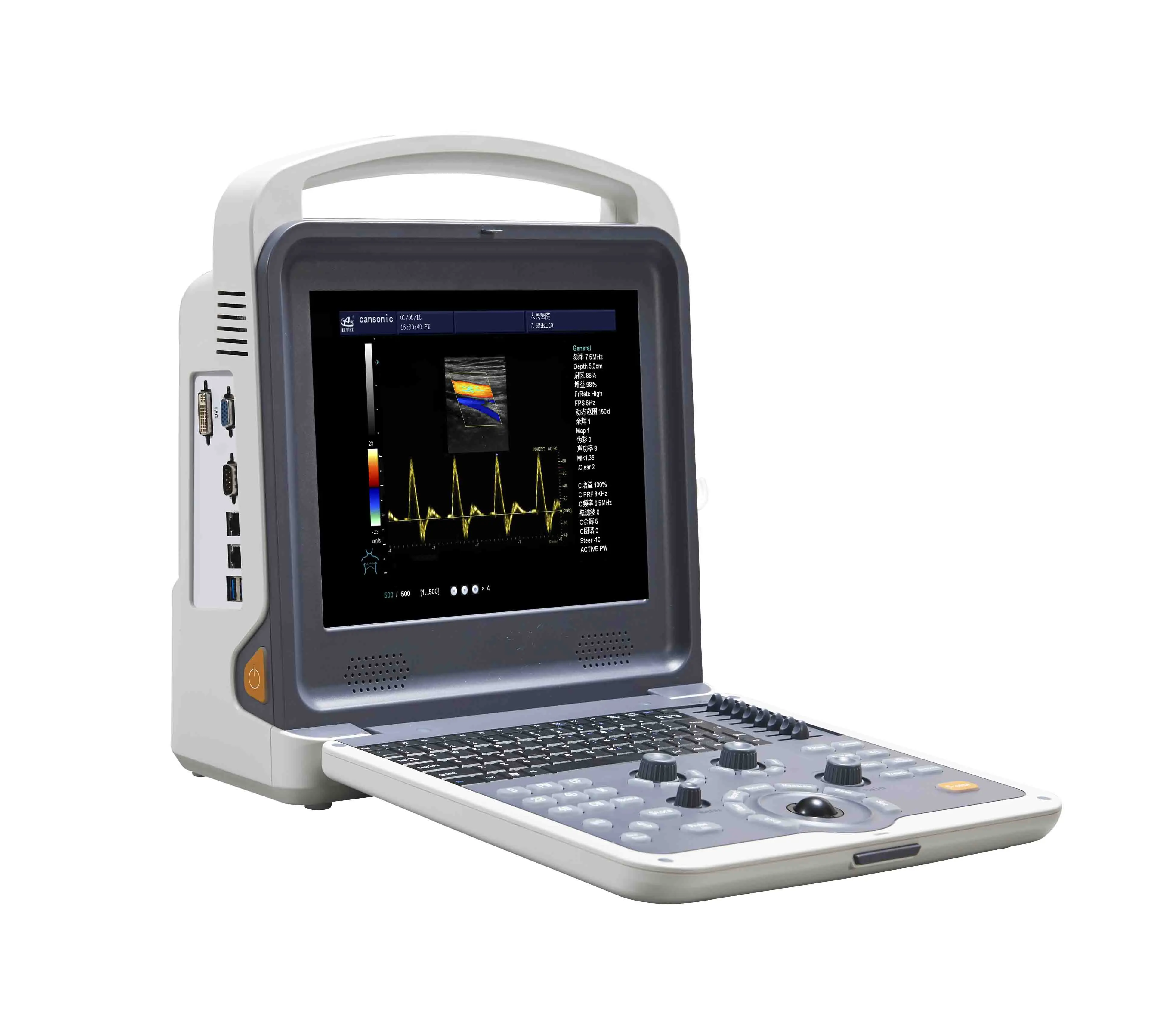 YSB-K2000 12" screen hight speed portable ultrasound scanner portable colour ultrasound machine
YSB-K2000 12" screen hight speed portable ultrasound scanner portable colour ultrasound machine