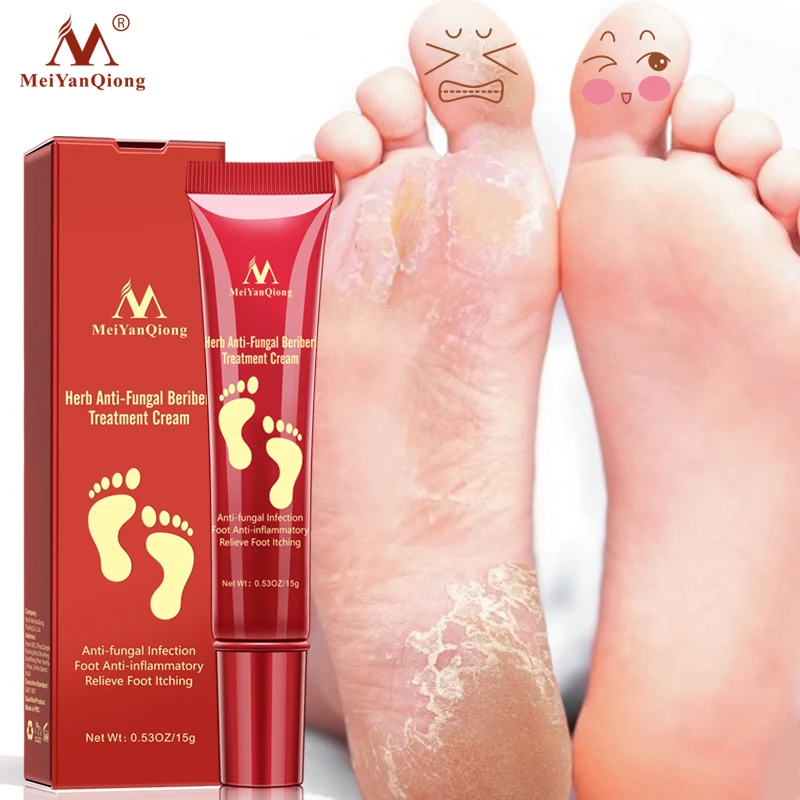 MeiYanQiong Herbal Foot Cream Treatment Anti Fungal Infection Onychomycosis Paronychia Toe Fungus Gel Repair Dry Crack Feet Care
MeiYanQiong Herbal Foot Cream Treatment Anti Fungal Infection Onychomycosis Paronychia Toe Fungus Gel Repair Dry Crack Feet Care