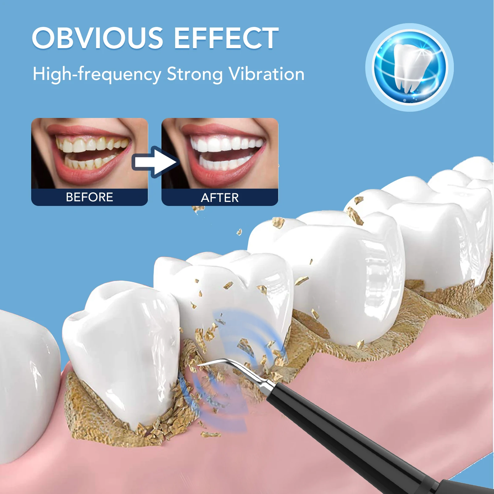 Electric Oral Irrigator Dental Scaler Tooth Frequency IPX6 Calculus Tartar Remover Healthy Gums Dentist Waterproof Teeth
Electric Oral Irrigator Dental Scaler Tooth Frequency IPX6 Calculus Tartar Remover Healthy Gums Dentist Waterproof Teeth