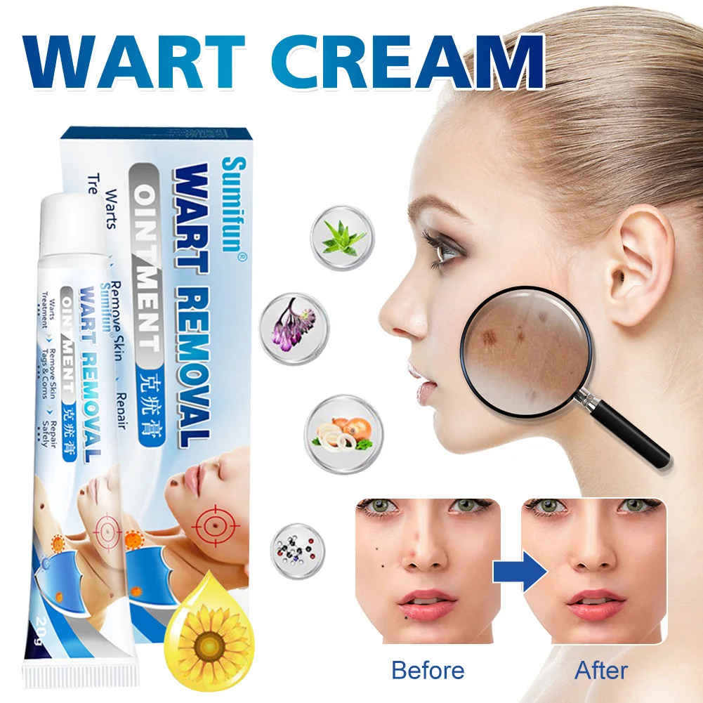 Skin Tag Remover Cream Safe & Effective Nourish Wart Callus Mole Milia Treatment Quick Removal Skin Face Care for Men Women
Skin Tag Remover Cream Safe & Effective Nourish Wart Callus Mole Milia Treatment Quick Removal Skin Face Care for Men Women