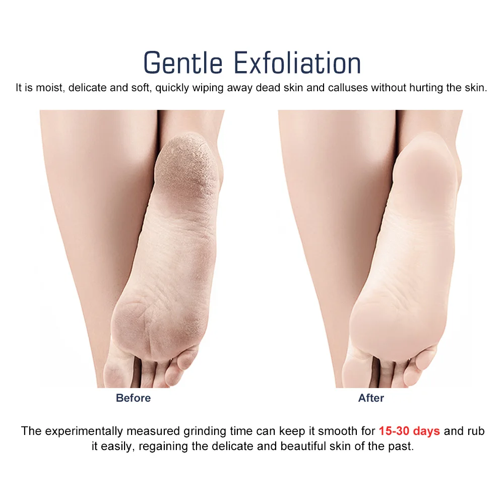 Foot Rasp Foot File Scrubber Pedicure Tools Callus Exfoliate Professional Foot Care Manicure Hard Dead Skin Callus Remover
Foot Rasp Foot File Scrubber Pedicure Tools Callus Exfoliate Professional Foot Care Manicure Hard Dead Skin Callus Remover