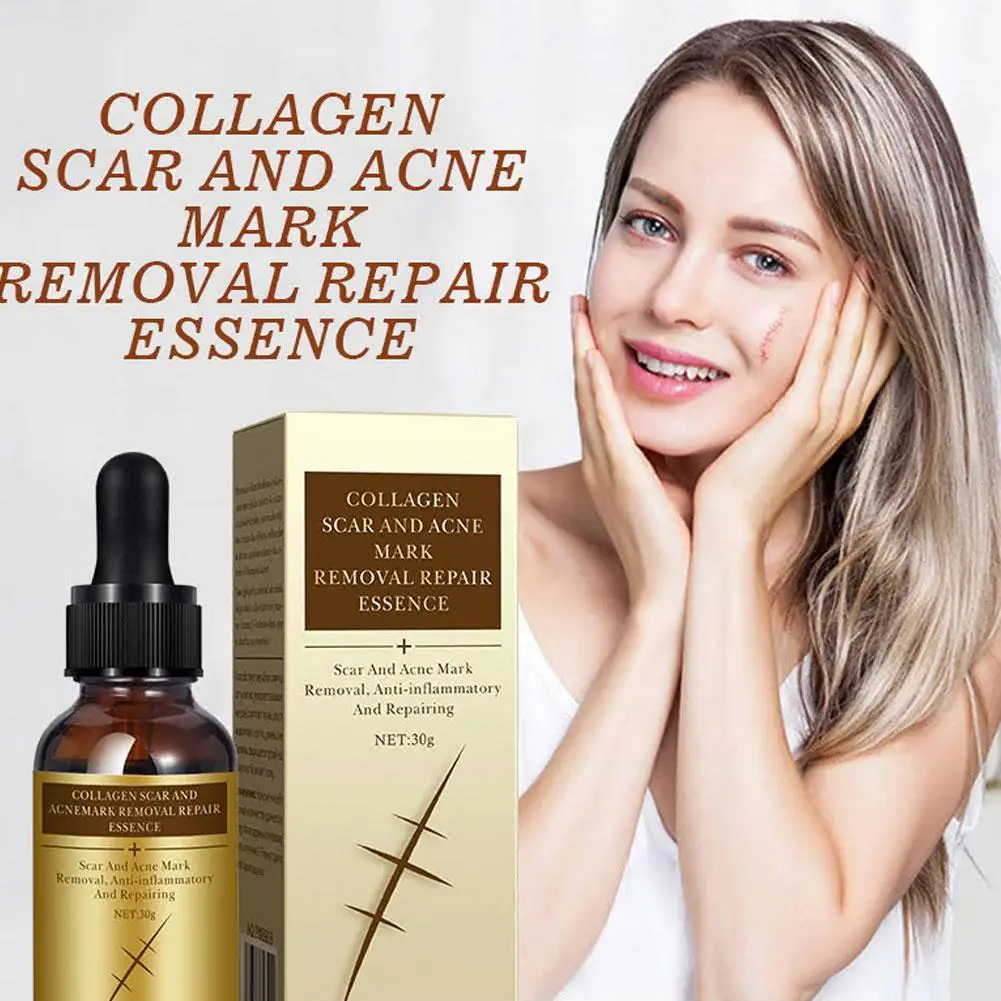 30ml Scar Repair Collagen Essence Remove Ance Burn Pimples Strentch Marks Scar Removal Smoothing Whitening Essence
30ml Scar Repair Collagen Essence Remove Ance Burn Pimples Strentch Marks Scar Removal Smoothing Whitening Essence