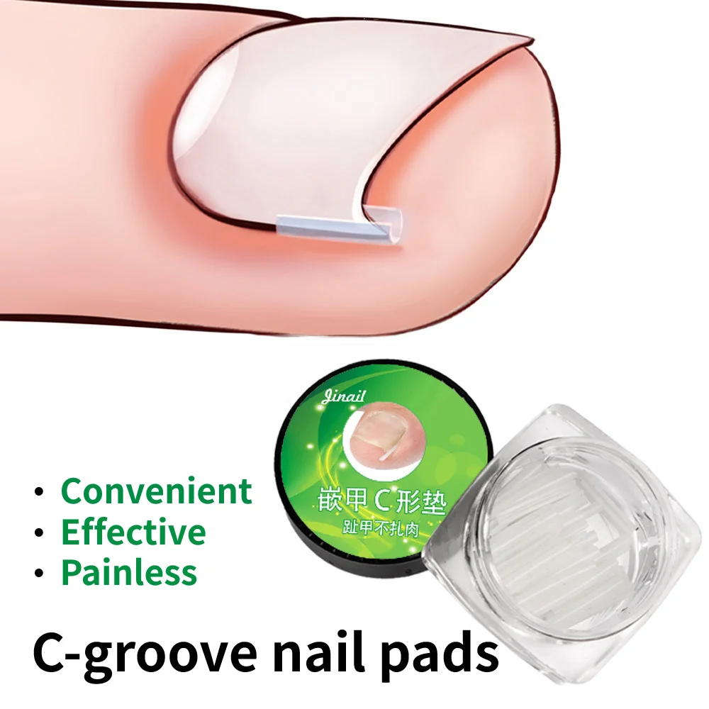 10Pcs Silicone Ingrown Nail Pad Ortho Nail Filling Nail Groove Pad Ingrown Nail Corrector Relief Pain Paronychia Correction Tool
10Pcs Silicone Ingrown Nail Pad Ortho Nail Filling Nail Groove Pad Ingrown Nail Corrector Relief Pain Paronychia Correction Tool