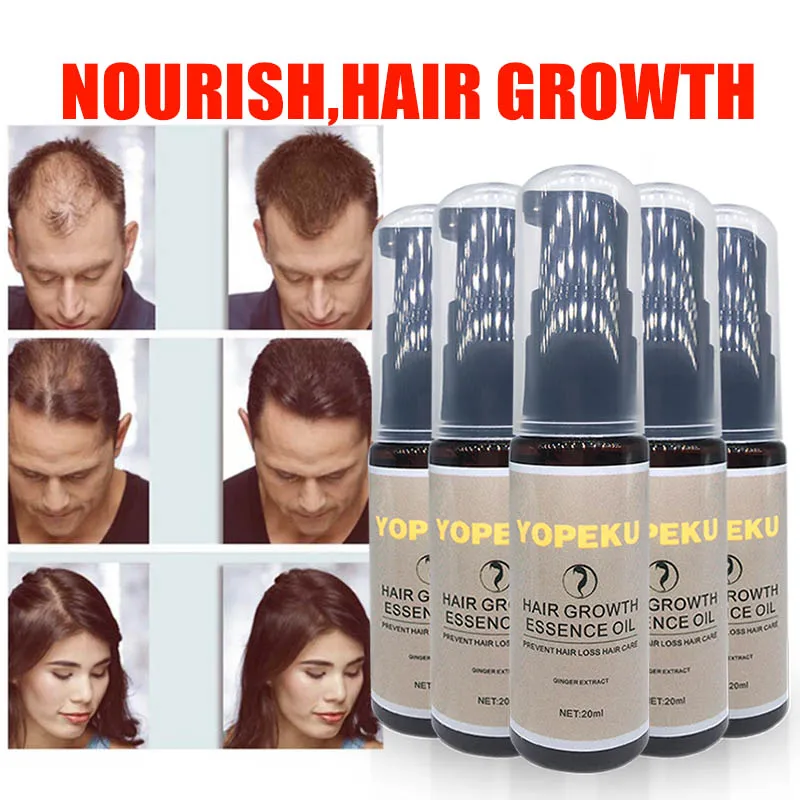 YOPEKU Hair Growth Essence Hair Loss Liquid Natural Pure Original Essential Oils Dense Hair Growth Serum Health Care Beauty
YOPEKU Hair Growth Essence Hair Loss Liquid Natural Pure Original Essential Oils Dense Hair Growth Serum Health Care Beauty