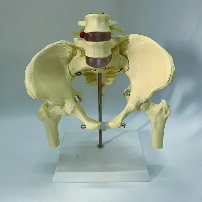 1:1 Human pelvic bone model skeleton femur sacrum lumbar vertebra Teaching medical explanation disc slipped 
1:1 Human pelvic bone model skeleton femur sacrum lumbar vertebra Teaching medical explanation disc slipped