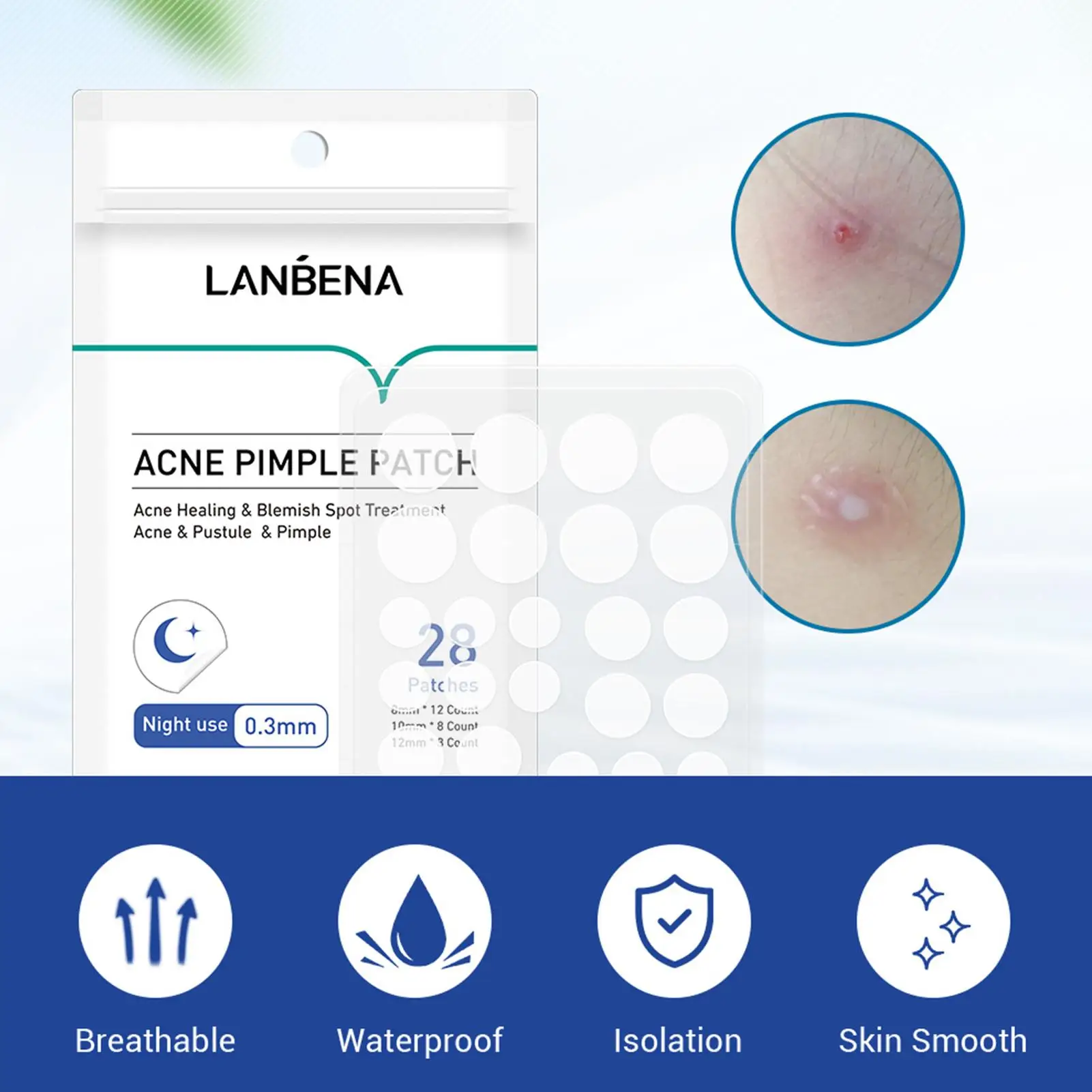 LANBENA, мягкое лечение кожи, водонепроницаемый патч для удаления прыщей и акне в ночное время
LANBENA, мягкое лечение кожи, водонепроницаемый патч для удаления прыщей и акне в ночное время