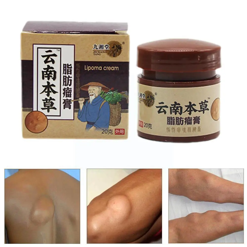 1pcs Lipoma Verwijdering Crème Behandelen Tumor Huid Gips Zwelling Pijnbestrijding Gezondheidszorg Exfoliërende Zalf Lichaa P5x5
1pcs Lipoma Verwijdering Crème Behandelen Tumor Huid Gips Zwelling Pijnbestrijding Gezondheidszorg Exfoliërende Zalf Lichaa P5x5