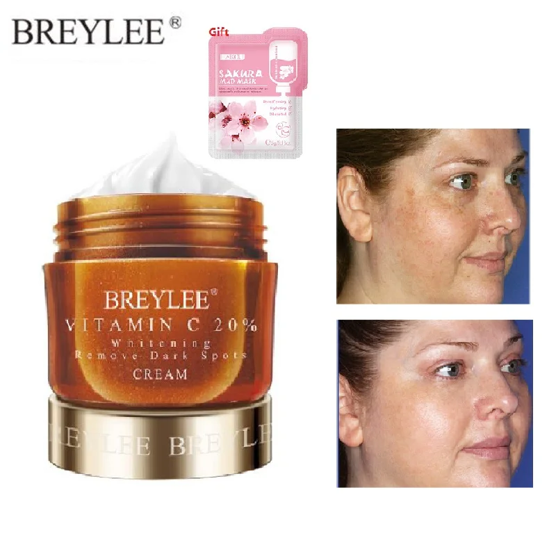 BREYLEE Vitamin C Face Cream VC Melanin Removal Freckle Removal Dark Spot Cream Whitening Moisturizing Day Cream Anti-Aging Care
BREYLEE Vitamin C Face Cream VC Melanin Removal Freckle Removal Dark Spot Cream Whitening Moisturizing Day Cream Anti-Aging Care