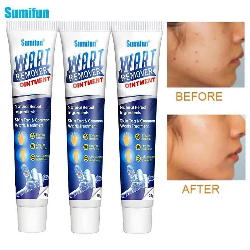 20g Skin Warts Remover Ointment Instant Blemish Removal Gel Herbal Ingredient No Scars Leaving Multifunctional Cream skin care
20g Skin Warts Remover Ointment Instant Blemish Removal Gel Herbal Ingredient No Scars Leaving Multifunctional Cream skin care