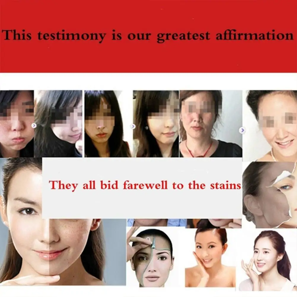 Powerful Whitening Freckle Cream Chinese Herbal Plant Skin Dark Cream Cream Spots Face 40g Whitening Freckles And Remove W6B3
Powerful Whitening Freckle Cream Chinese Herbal Plant Skin Dark Cream Cream Spots Face 40g Whitening Freckles And Remove W6B3