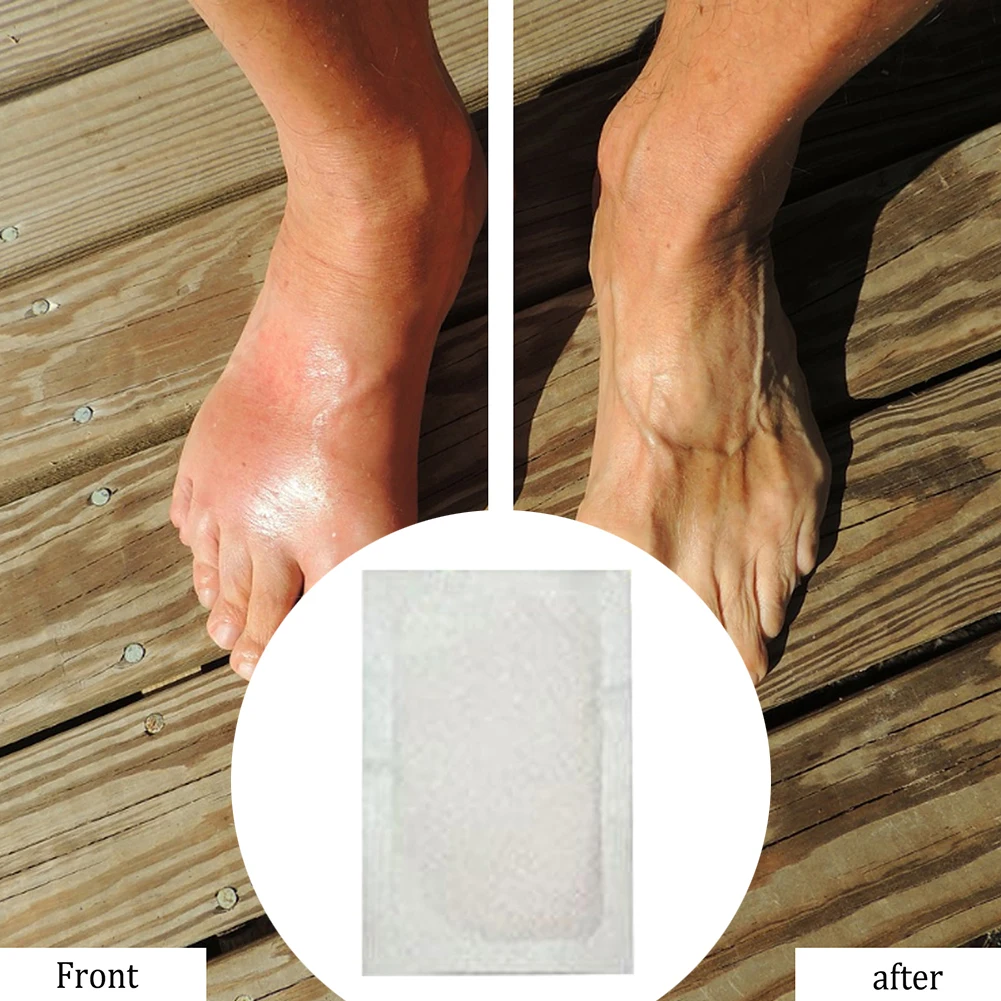 10/20/30pcs Detox Foot Pads Knee Joint Pain Relieving Patches Medical Patch Relaxation Muscle Massage Chinese medicine Pads
10/20/30pcs Detox Foot Pads Knee Joint Pain Relieving Patches Medical Patch Relaxation Muscle Massage Chinese medicine Pads