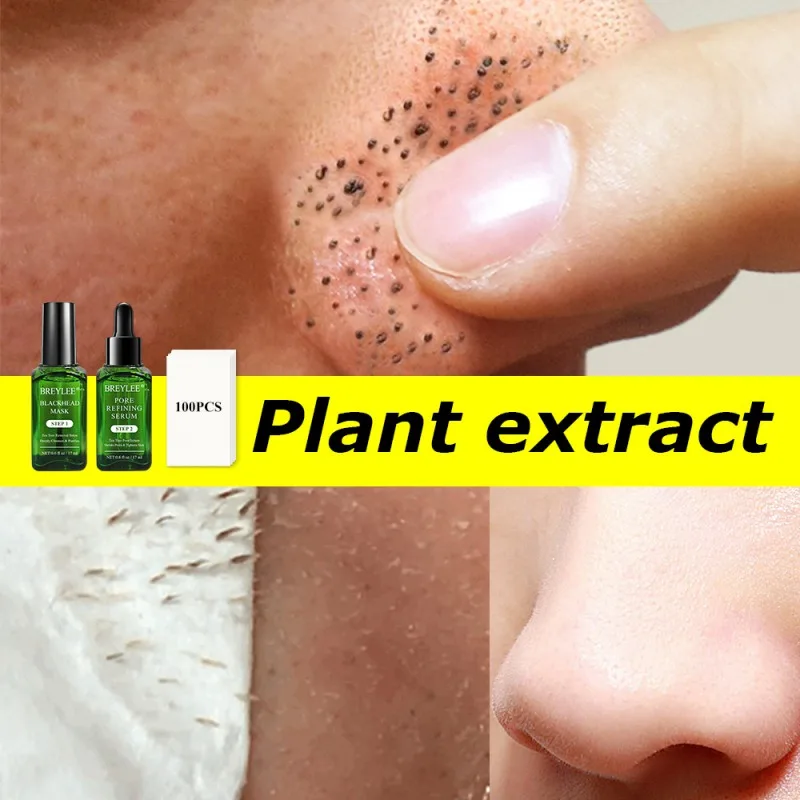 17ml Green Tea Extract Fluid Serum Blackhead Shrink Pore Essence Liquid Pore Refining Acne Treatment Mask Skin Face Care
17ml Green Tea Extract Fluid Serum Blackhead Shrink Pore Essence Liquid Pore Refining Acne Treatment Mask Skin Face Care