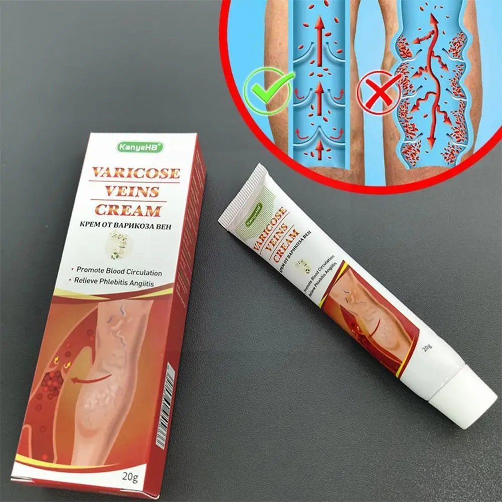 Varicose Vein Ointment Vasculitis Phlebitis Treatment Pain Plaster Cream Remove Body Relief Spider Medical Care J9G7
Varicose Vein Ointment Vasculitis Phlebitis Treatment Pain Plaster Cream Remove Body Relief Spider Medical Care J9G7