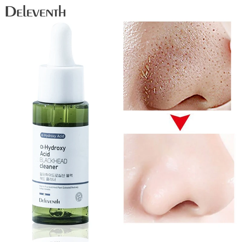 

Lactobionic Acid Remove Blackhead Serum Acne Treatment Shrink Pores Oil-Control Face Essence Clean Tighten Pore Smooth Skin Care