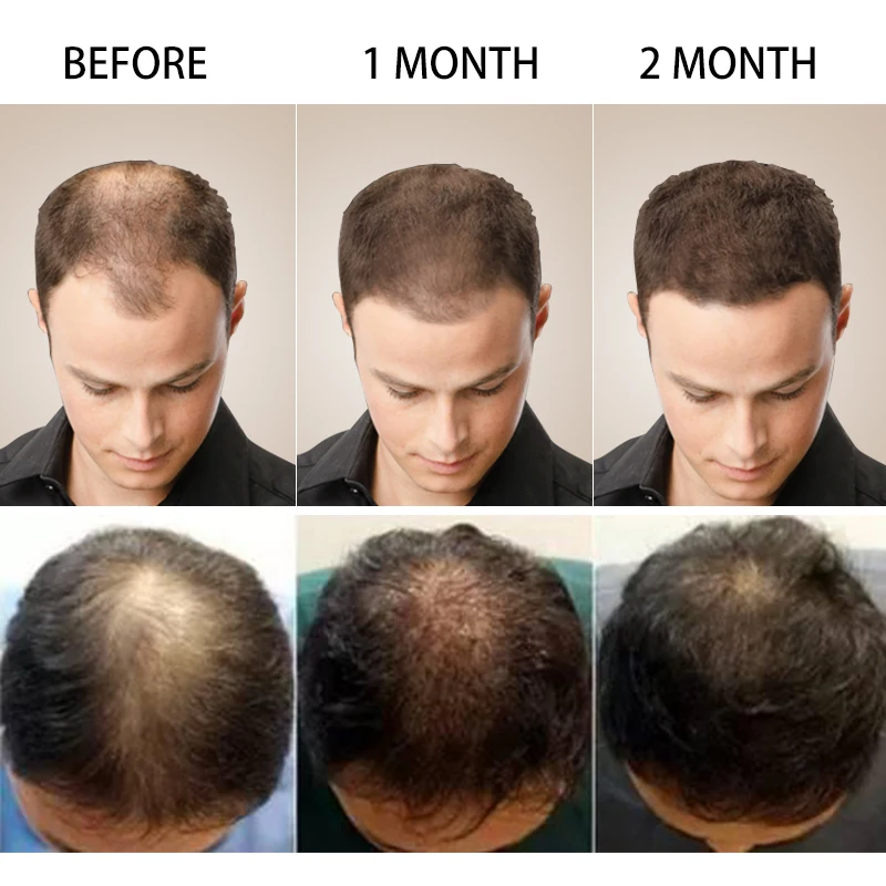 Brazilian Keratin Hair Growth Shampoo & Conditioner Set Enhance for Hair Regrowth Gifts Set Repair Prevent Men Women Care 200ml
Brazilian Keratin Hair Growth Shampoo & Conditioner Set Enhance for Hair Regrowth Gifts Set Repair Prevent Men Women Care 200ml