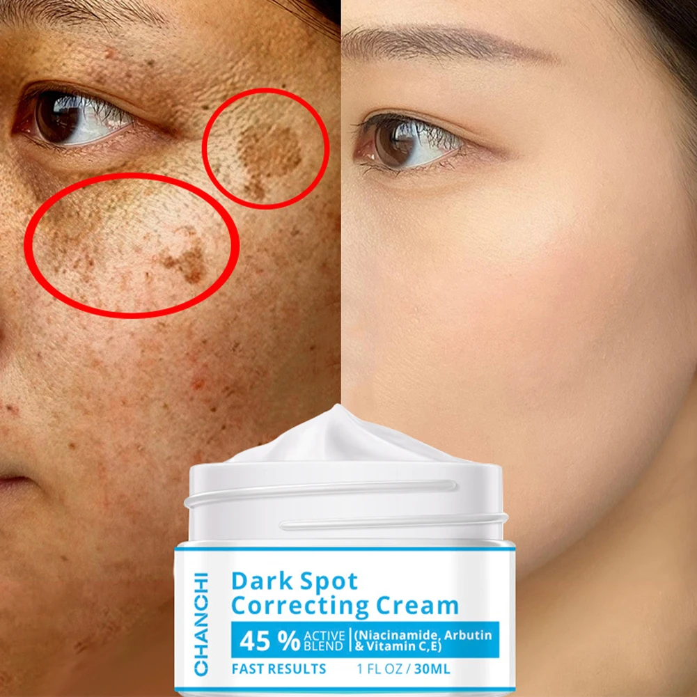 30ml Whitening Freckle Cream Remove Melasma Cream Remove Freckle Age Spot Dark Spots Brighten Skin Anti-Aging Skin Lightening
30ml Whitening Freckle Cream Remove Melasma Cream Remove Freckle Age Spot Dark Spots Brighten Skin Anti-Aging Skin Lightening