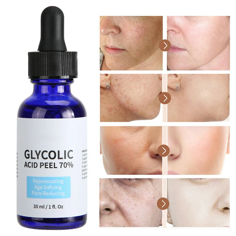 30ml Glycolic Acid Serum Moisturizing Fade Fine Line Smooth Wrinkles Tighten Skin Improve Aging Cutin Pimple Marks Hydrating
30ml Glycolic Acid Serum Moisturizing Fade Fine Line Smooth Wrinkles Tighten Skin Improve Aging Cutin Pimple Marks Hydrating