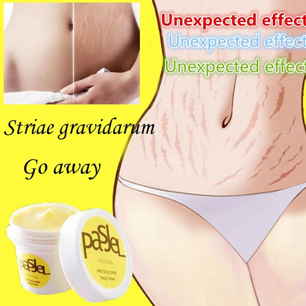 New Stretch Marks Remover Essential Oil Skin Care Treatment Cream For Stretch Mark Removal Maternity Slackline For Pregnant Oils
New Stretch Marks Remover Essential Oil Skin Care Treatment Cream For Stretch Mark Removal Maternity Slackline For Pregnant Oils