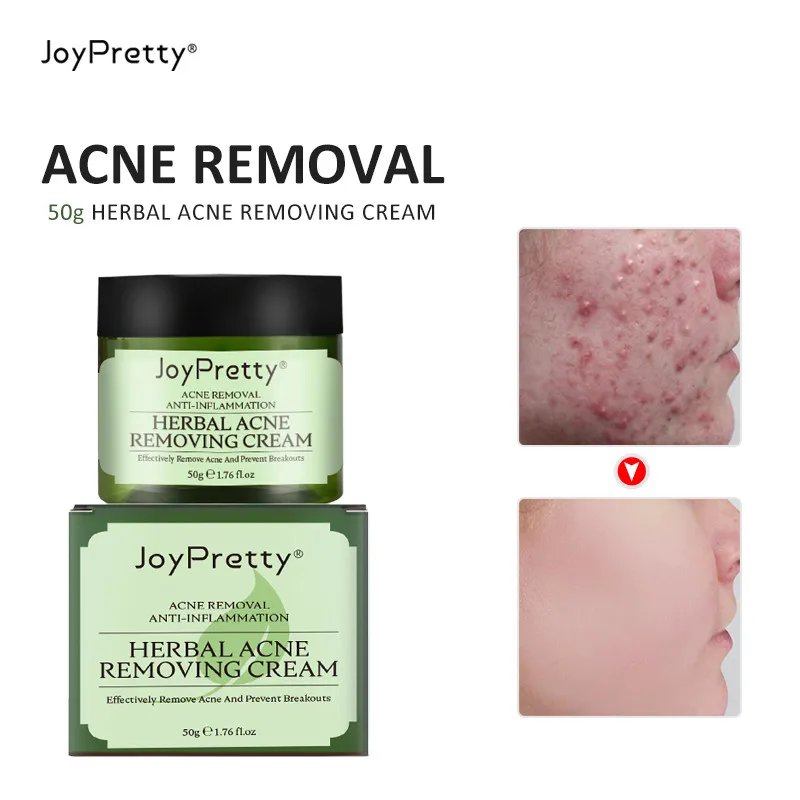 Herbal Against Anti Face Acne Treatment Cream Remove Acne Gel Cleans Repairs Skin Against Pimple Moisturizing Shrink Pores Cream
Herbal Against Anti Face Acne Treatment Cream Remove Acne Gel Cleans Repairs Skin Against Pimple Moisturizing Shrink Pores Cream