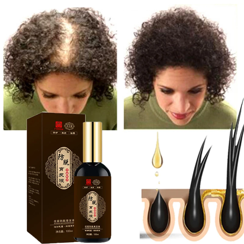 Herbal Bald Hair Growth Thick Essential Oils Prevent Hair Loss Treatment Product Repair Damaged Serum Hair Care For Men Women
Herbal Bald Hair Growth Thick Essential Oils Prevent Hair Loss Treatment Product Repair Damaged Serum Hair Care For Men Women