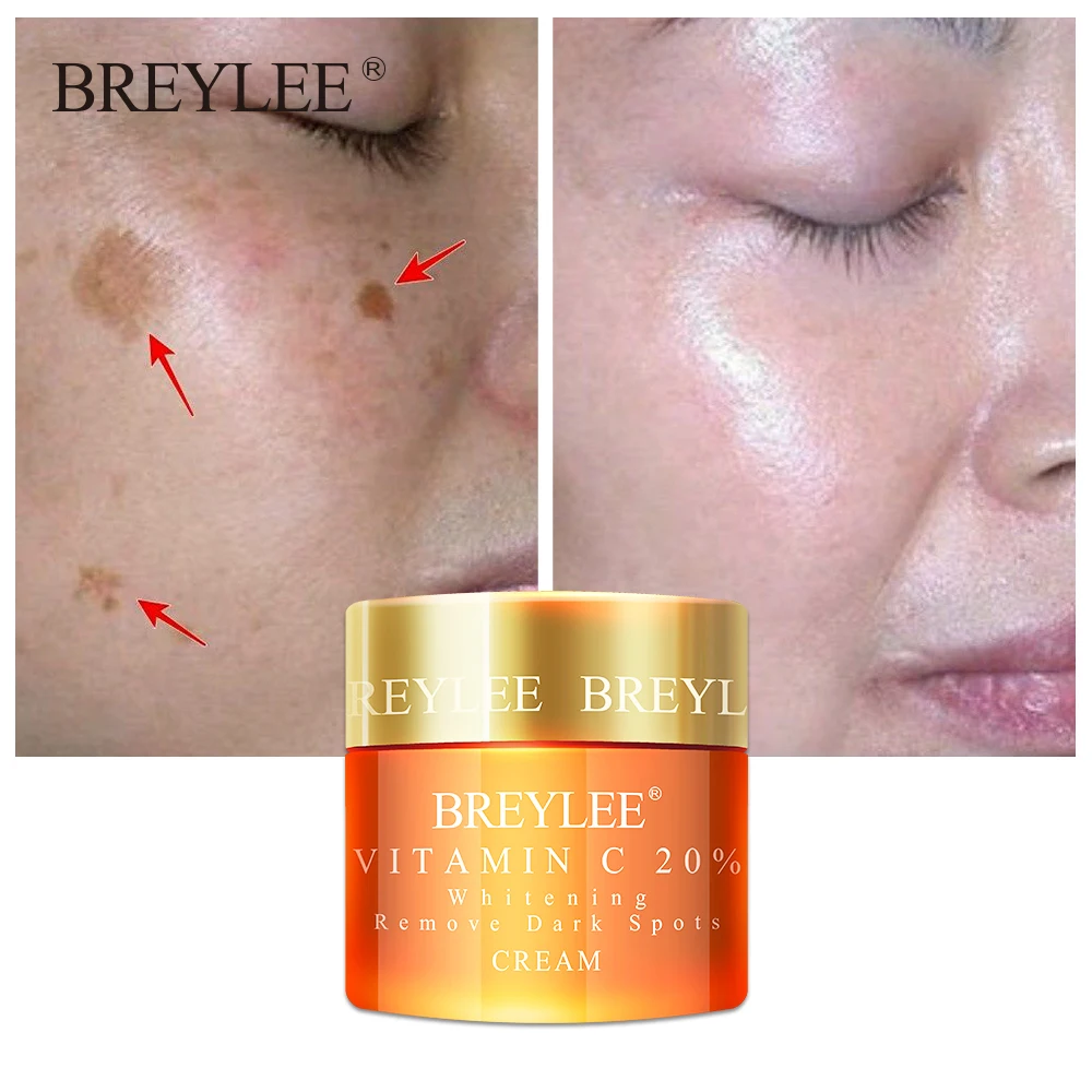 

Breylee Vitamin C 20% Vc Whitening Facial Cream Repair Fade Freckles Remove Dark Spots Melanin Remover Brightening Face Care 01
